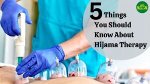Read more about the article 5 things you should know about hijama therapy
