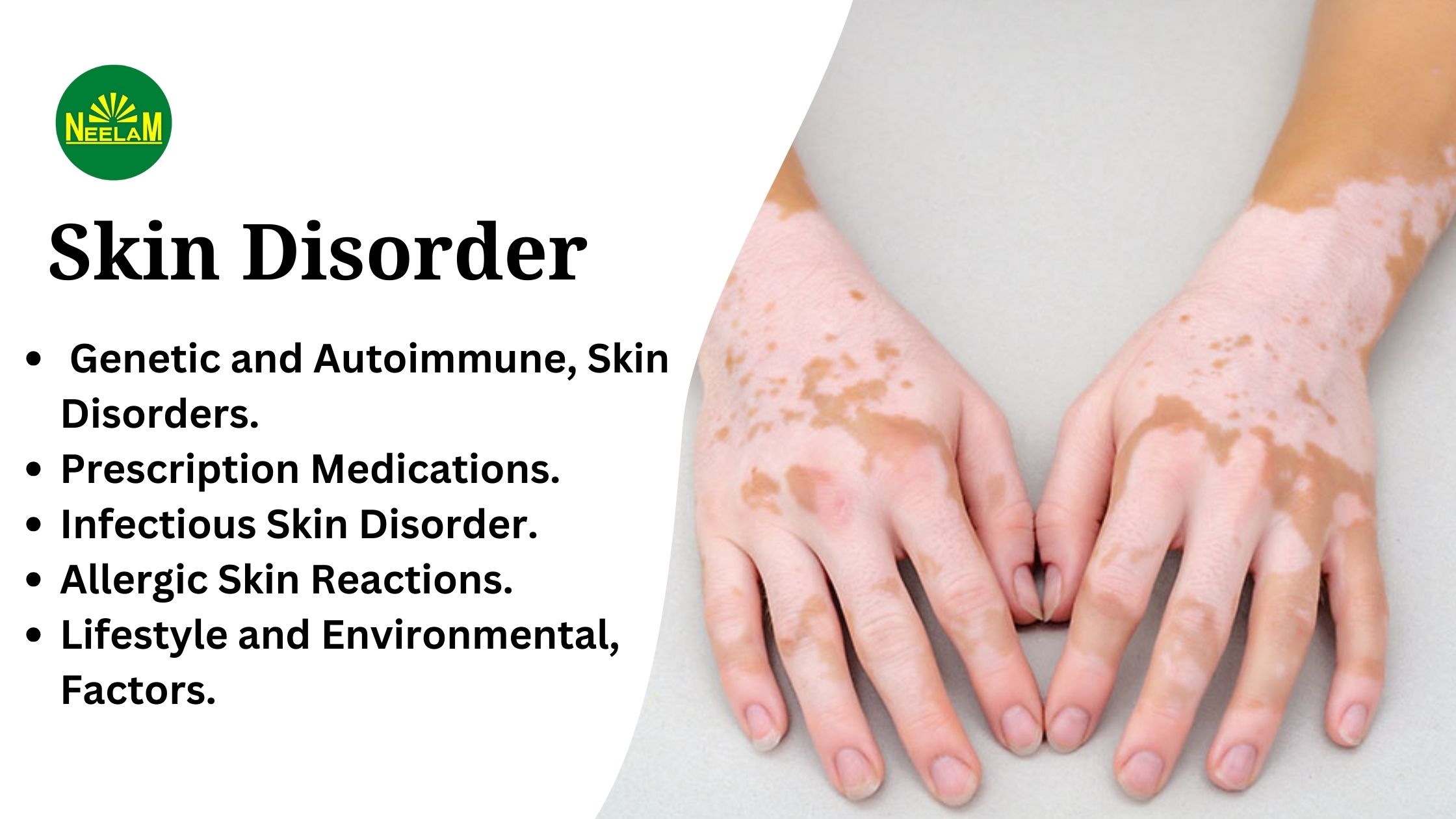 You are currently viewing What is Skin Disorder?