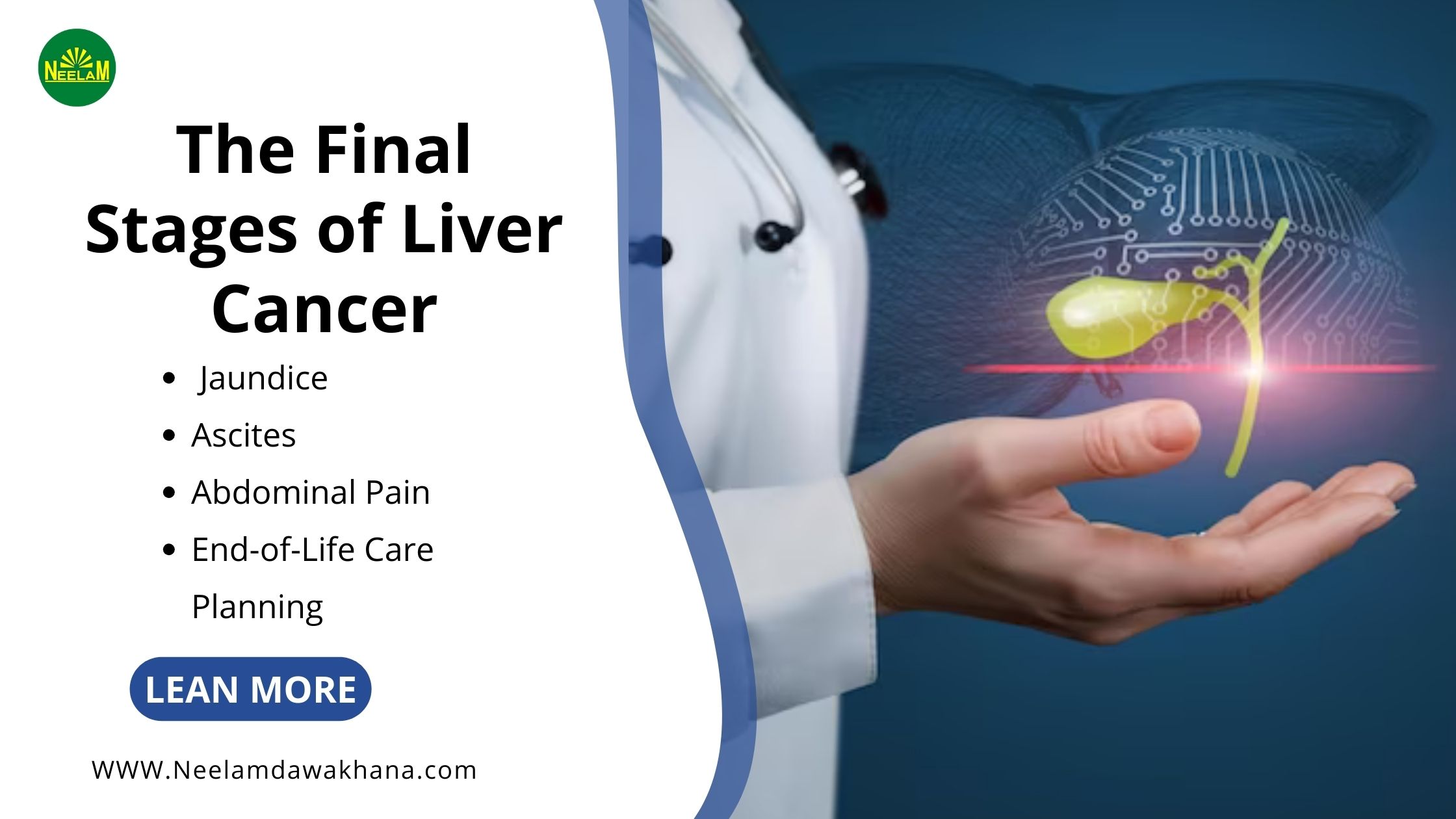 You are currently viewing Understanding The Final Stages of Liver Cancer: Symptoms, Treatments, and Care