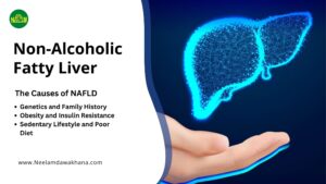 Read more about the article Nonalcoholic Fatty Liver Disease Symptoms and Causes
